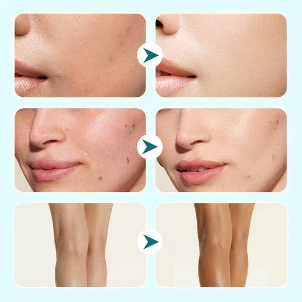 🔥Siste dag kjøp 1 få 1 gratis!🎁All-in-one fuktighetskrem, concealer og dekning 💧✨ Lett og vannfast