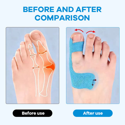 Ferdigskåret kinesiologitape for hallux valgus